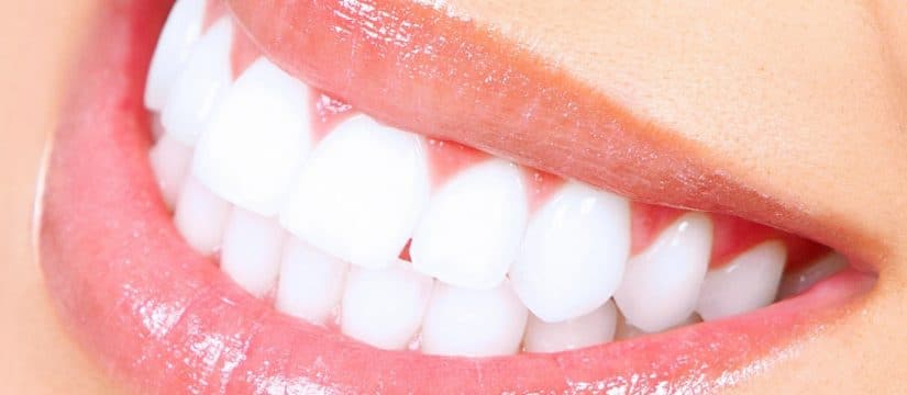 Zoom professional in-chair teeth whitening